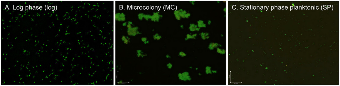 spirochetes in different phases